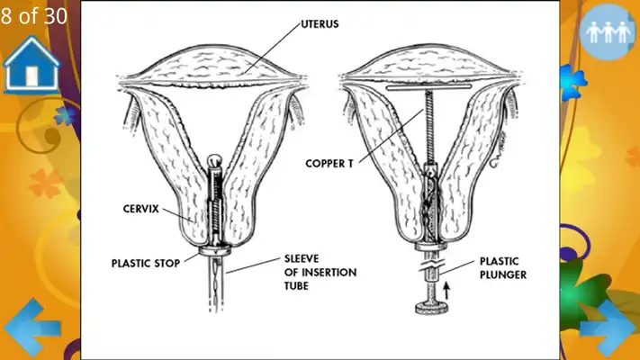 Play Methods For Birth Control