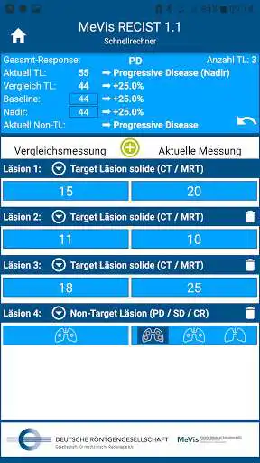 Play MeVis RECIST 1.1 as an online game online MeVis RECIST 1.1 with UptoPlay de.mevis.recist Play MeVis RECIST 1.1 as an online game MeVis RECIST 1.1 with UptoPlay