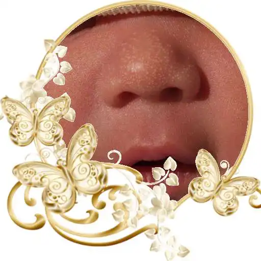 Play Milia in Babies Remedies APK