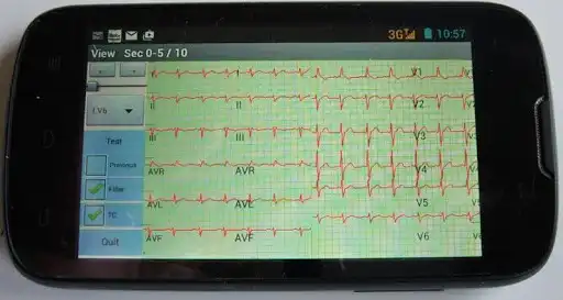 Play Mobile ecg recording as an online game Mobile ecg recording with UptoPlay
