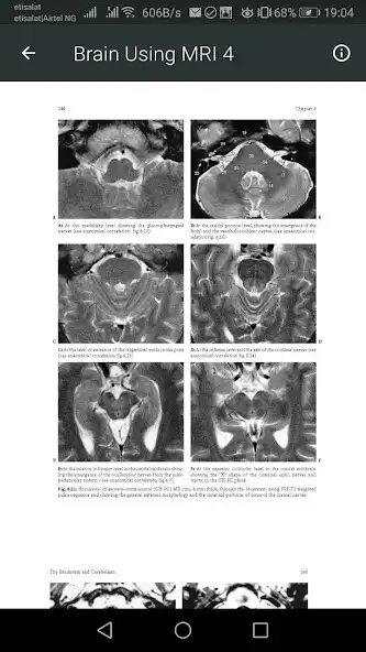 Play MRI Scan View Anatomy of Brain  and enjoy MRI Scan View Anatomy of Brain with UptoPlay