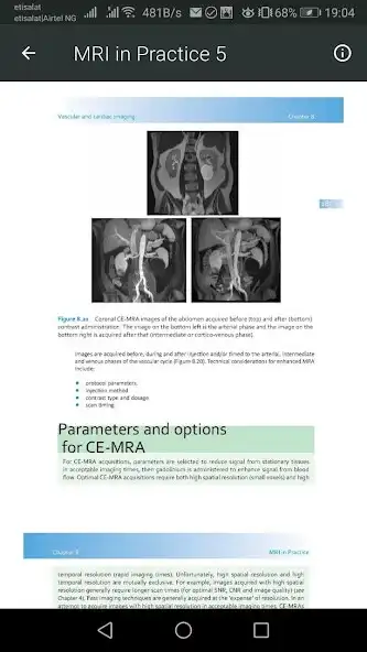 Play MRI Scan View Anatomy of Brain as an online game MRI Scan View Anatomy of Brain with UptoPlay