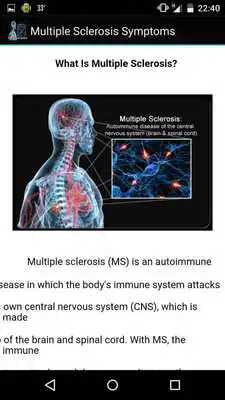 Play Multiple Sclerosis Symptoms Play Multiple Sclerosis Symptoms
