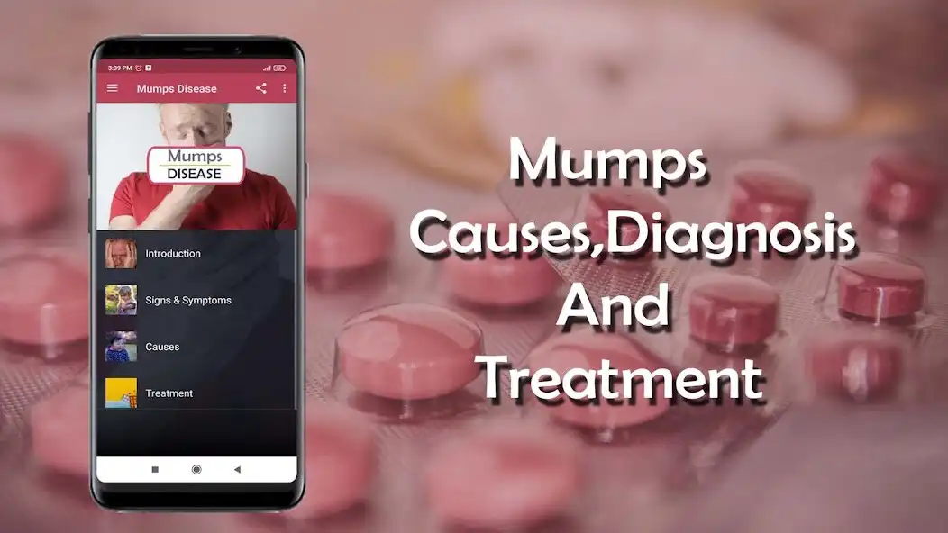 Play Mumps - Causes, Diagnosis, and  and enjoy Mumps - Causes, Diagnosis, and with UptoPlay
