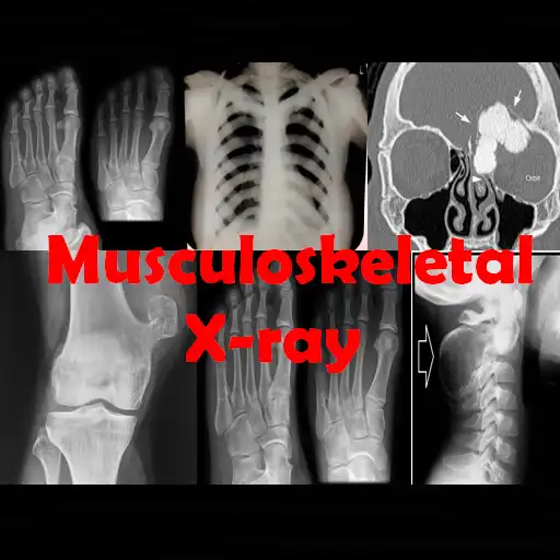 Play Musculoskeletal X-ray App APK Play Musculoskeletal X-ray App APK