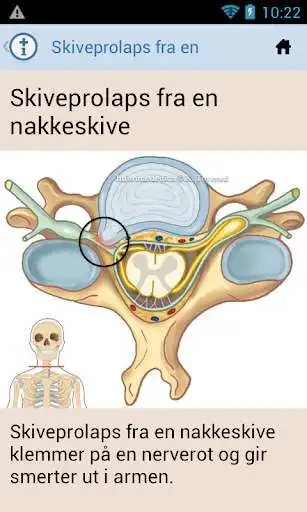 Play Muskel-Skjelett (IM-App)  and enjoy Muskel-Skjelett (IM-App) with UptoPlay