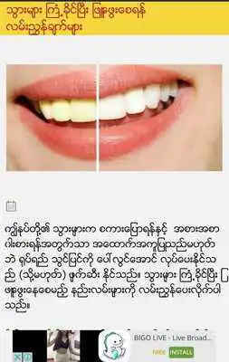 Play Myanmar Love