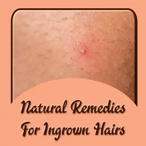 Play Natural Remedies for Ingrown Hair APK