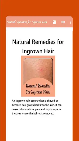 Play Natural Remedies for Ingrown Hair as an online game Natural Remedies for Ingrown Hair with UptoPlay