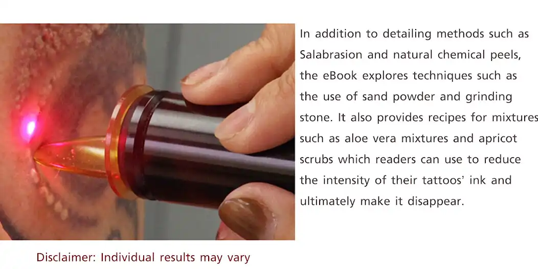 Play Natural Tattoo Removal as an online game Natural Tattoo Removal with UptoPlay