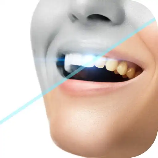 Play natural teeth whitening APK