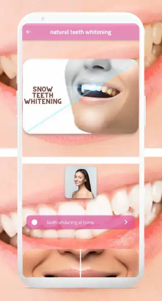 Play natural teeth whitening and enjoy natural teeth whitening with UptoPlay Play natural teeth whitening and enjoy natural teeth whitening with UptoPlay
