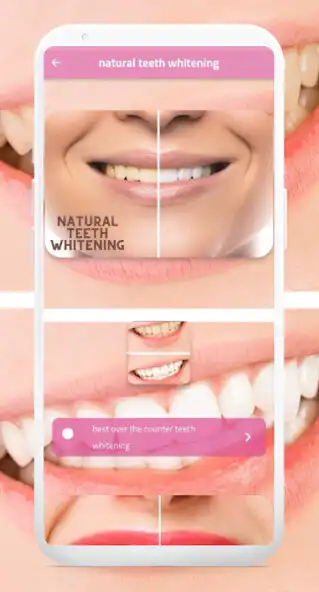 Play natural teeth whitening as an online game online natural teeth whitening with UptoPlay Play natural teeth whitening as an online game natural teeth whitening with UptoPlay