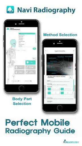 Play Navi Radiography Lite