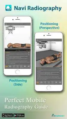 Play Navi Radiography Lite