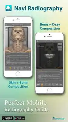 Play Navi Radiography Lite