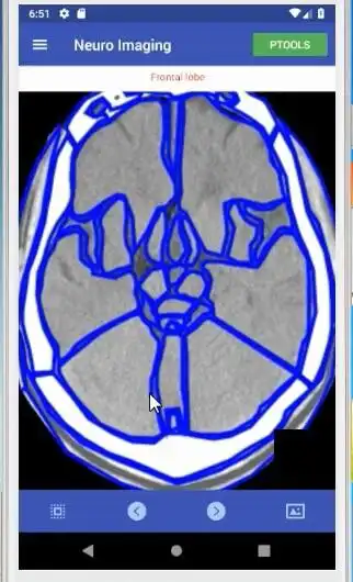 Play NeuroImaging as an online game NeuroImaging with UptoPlay