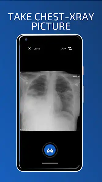 Play Neuron Chest X-Ray Classifier as an online game Neuron Chest X-Ray Classifier with UptoPlay
