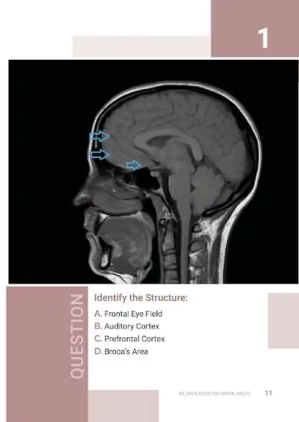 Play Normal Radiology: Brain MRI-1 and enjoy Normal Radiology: Brain MRI-1 with UptoPlay Play Normal Radiology: Brain MRI-1 and enjoy Normal Radiology: Brain MRI-1 with UptoPlay