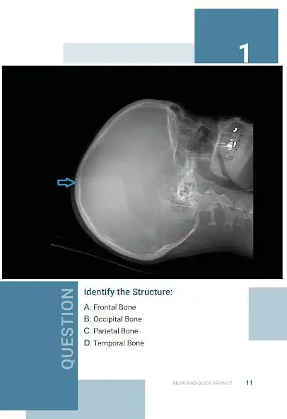 Play Normal Radiology: CT Brain and enjoy Normal Radiology: CT Brain with UptoPlay Play Normal Radiology: CT Brain and enjoy Normal Radiology: CT Brain with UptoPlay