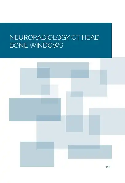 Play Normal Radiology: CT Brain as an online game online Normal Radiology: CT Brain with UptoPlay Play Normal Radiology: CT Brain as an online game Normal Radiology: CT Brain with UptoPlay