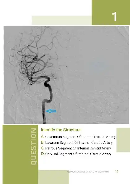 Play Normal Radiology: MRA Head and enjoy Normal Radiology: MRA Head with UptoPlay Play Normal Radiology: MRA Head and enjoy Normal Radiology: MRA Head with UptoPlay