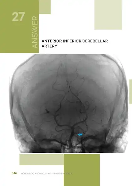 Play Normal Radiology: MRA Head as an online game online Normal Radiology: MRA Head with UptoPlay Play Normal Radiology: MRA Head as an online game Normal Radiology: MRA Head with UptoPlay