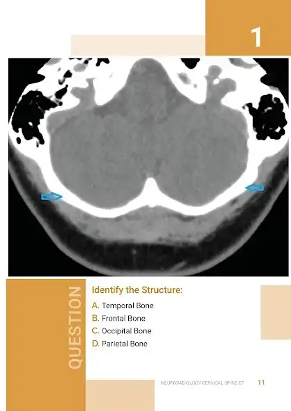 Play Normal Radiology: Spine CT and enjoy Normal Radiology: Spine CT with UptoPlay Play Normal Radiology: Spine CT and enjoy Normal Radiology: Spine CT with UptoPlay