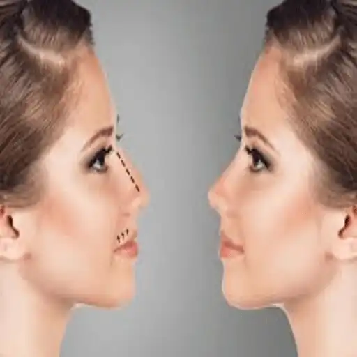 Play Nose reduction exercises APK
