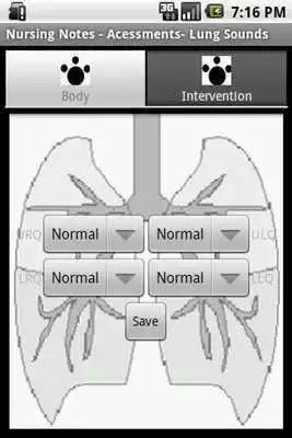 Play NurseWorks Demo Lung Sounds