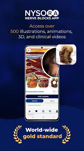 Play NYSORA Nerve Blocks  and enjoy NYSORA Nerve Blocks with UptoPlay
