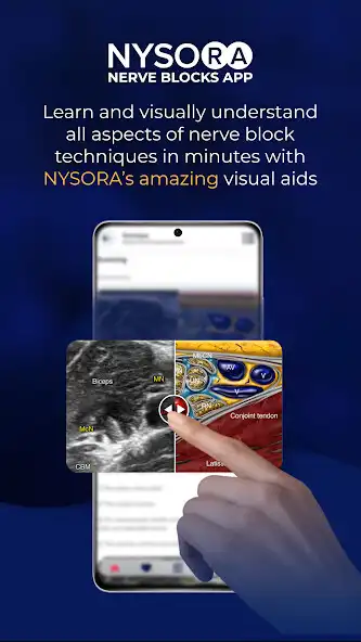 Play NYSORA Nerve Blocks as an online game NYSORA Nerve Blocks with UptoPlay