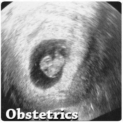 Run free android online Obstetrics APK Run free android online Obstetrics APK