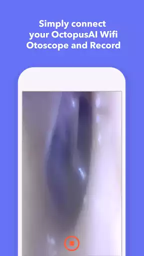 Play Octopus AI - Otoscope as an online game Octopus AI - Otoscope with UptoPlay