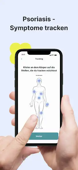 Play Orya – App bei Schuppenflechte as an online game Orya – App bei Schuppenflechte with UptoPlay
