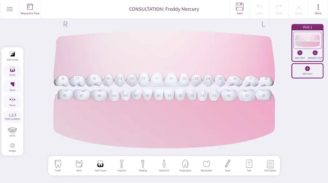 Play OsstellConnect as an online game OsstellConnect with UptoPlay