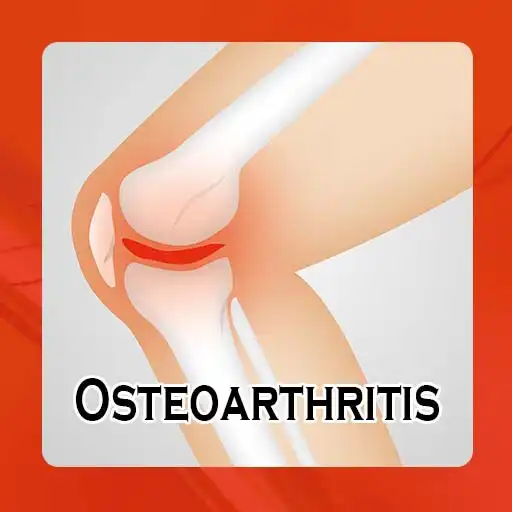 Play Osteoarthritis - Causes, Diagn APK Play Osteoarthritis - Causes, Diagn APK