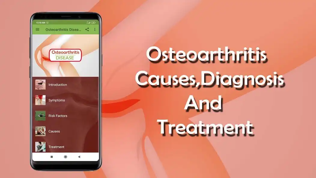 Play Osteoarthritis - Causes, Diagn  and enjoy Osteoarthritis - Causes, Diagn with UptoPlay
