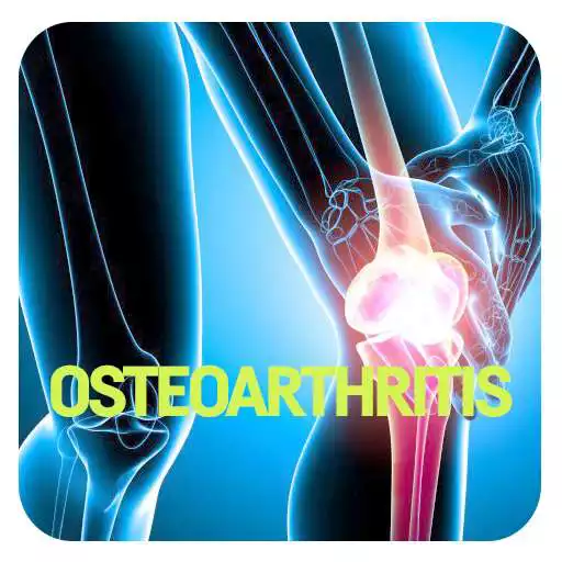 Free play online Osteoarthritis Disease APK Free play online Osteoarthritis Disease APK