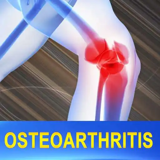 Run free android online Osteoarthritis Joint Pain Treatment Home Remedies APK Run free android online Osteoarthritis Joint Pain Treatment Home Remedies APK
