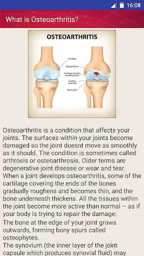 Play APK Osteoarthritis Joint Pain Treatment Home Remedies  and enjoy Osteoarthritis Joint Pain Treatment Home Remedies using Ap
