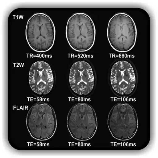 Play Overview of MRI Pulse Sequences APK