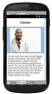 Play Pagets Of The Breast Disease