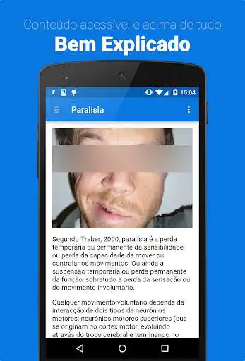 Play Paralisia Facial