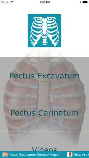 Play Pectus Clinic.  and enjoy Pectus Clinic. with UptoPlay