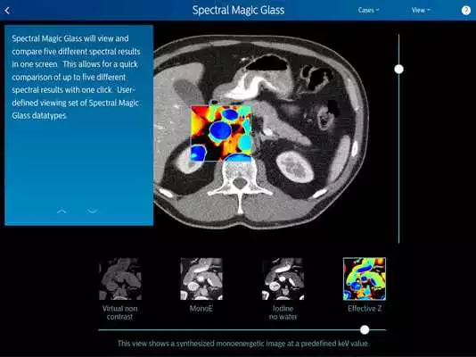 Play Philips IQon Spectral CT Fundamentals.