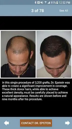 Play Plastic Surgery  Hair Restore as an online game Plastic Surgery  Hair Restore with UptoPlay