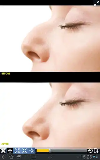 Play Plastic Surgery Simulator Lite  and enjoy Plastic Surgery Simulator Lite with UptoPlay