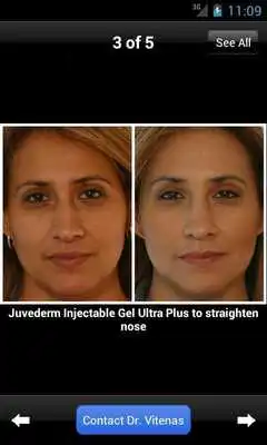 Play Plastic Surgery w/ Dr. Vitenas Play Plastic Surgery w/ Dr. Vitenas