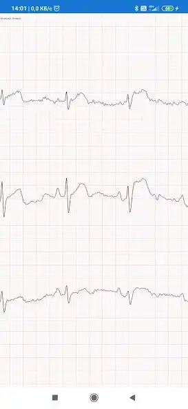 Play PMHM - VivoSpiro® Mobile as an online game online PMHM - VivoSpiro® Mobile with UptoPlay Play PMHM - VivoSpiro® Mobile as an online game PMHM - VivoSpiro® Mobile with UptoPlay